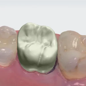 3Shape Design Studio