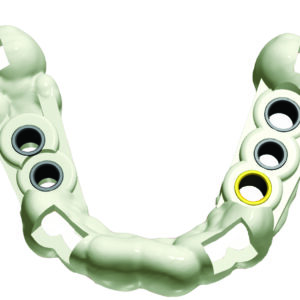 3Shape Implant Studio